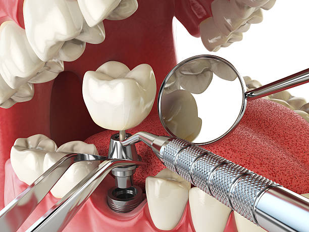 Best Emergency Treatment for Oral Infections in Youngstown, OH